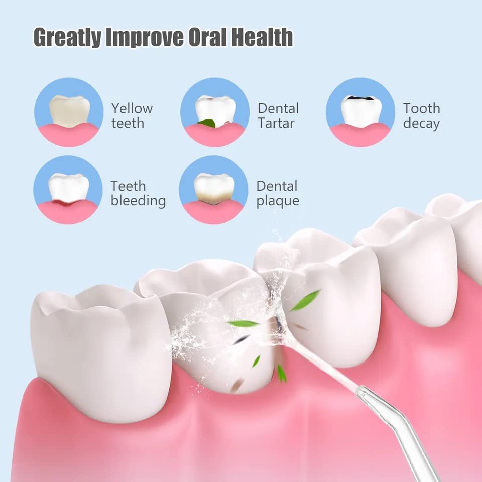 SmileJet - Rechargeable Dental Water Flosser